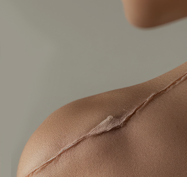 한땀성형외과 흉터 치료